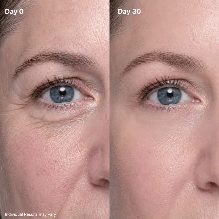 🎃 Halloween Flash Sale! Buy 1 Get 1 FREE – Eye Renewal Cream 👻🔥
